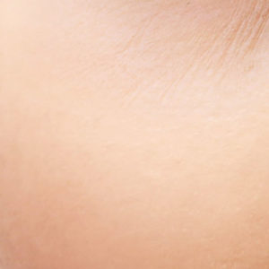 A close up of a person's cheek
