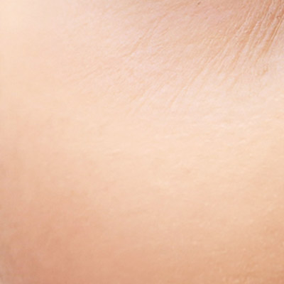 A close up of a person's cheek