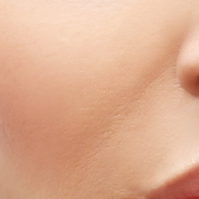 Wrinkles that travel from the nose to the mouth